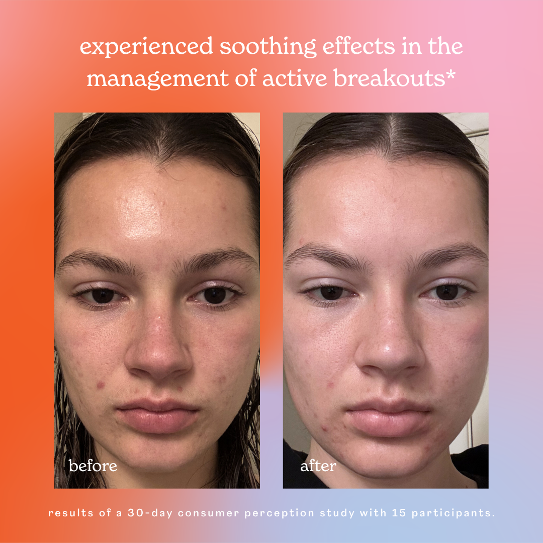 skin rescue hypochlorous acid face & skin spray