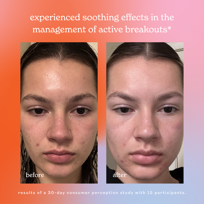 skin rescue hypochlorous acid face &amp; skin spray