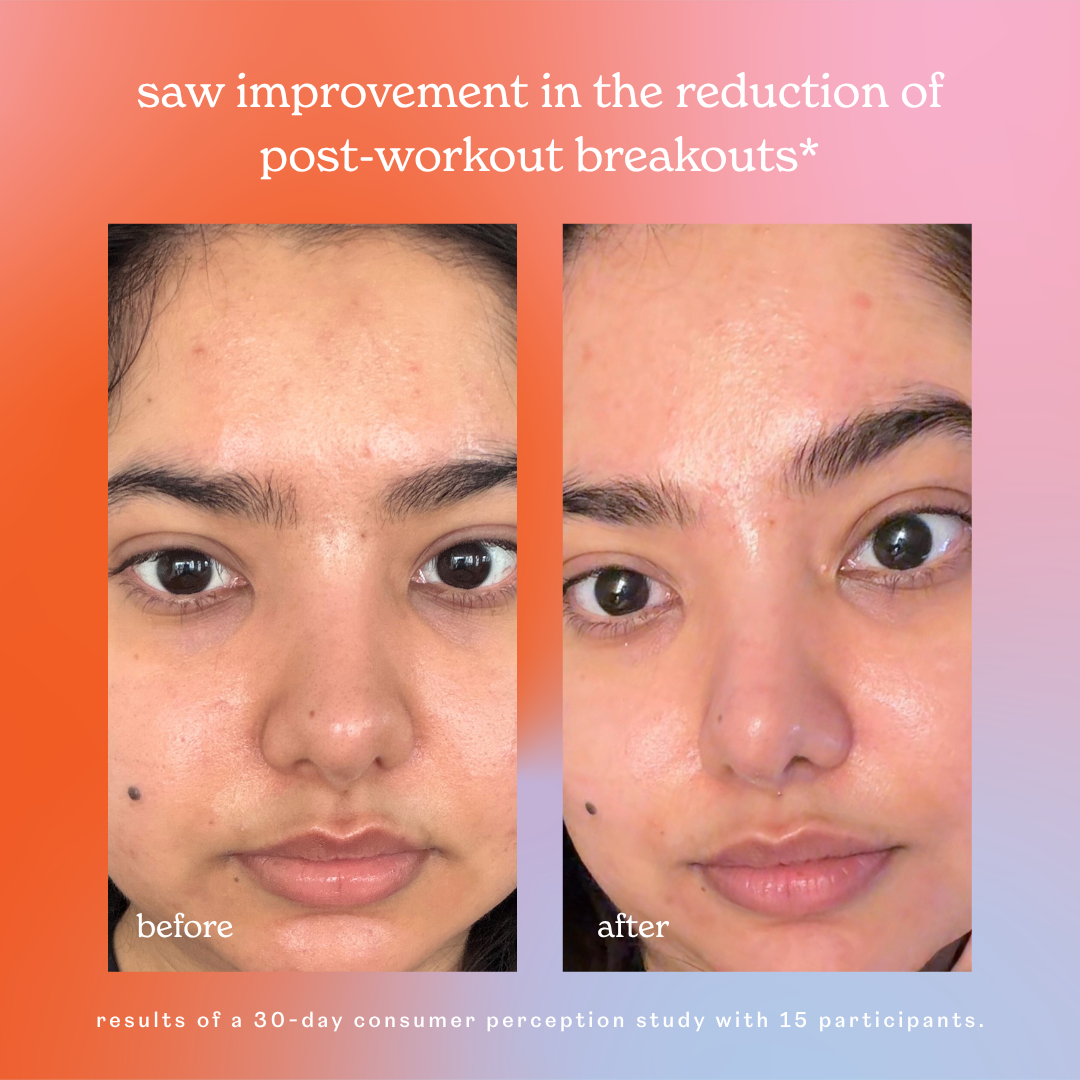 skin rescue hypochlorous acid face &amp; skin spray