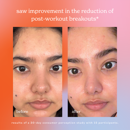 skin rescue hypochlorous acid face &amp; skin spray